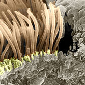 Cilia/Microvilli (scanning electron microscopy)