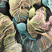 Kidney Glomerulus (scanning electron microscopy)