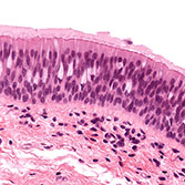 Respiratory Epithelium (larynx)