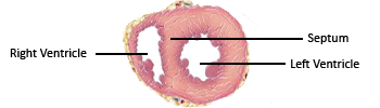 diagram of ventricle chamber